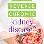 Can I Reverse Ckd?