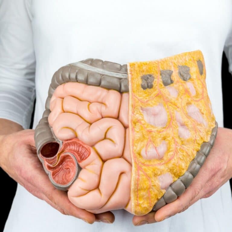 Colon And Kidney Disease