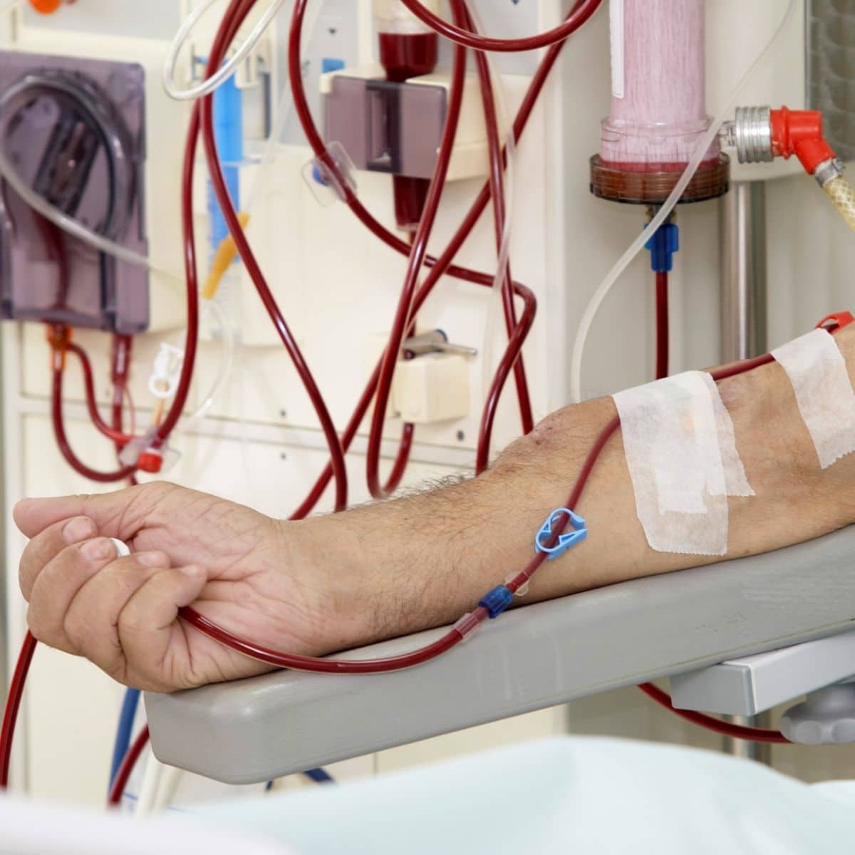 Patient dialysis session