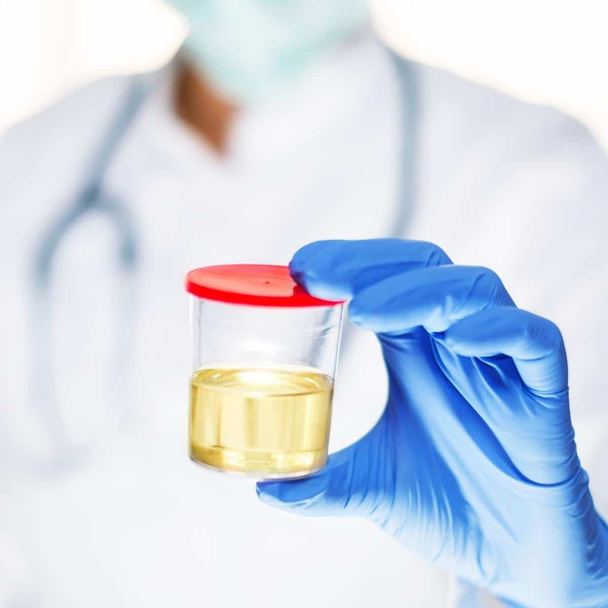 Doctor holding urine sample