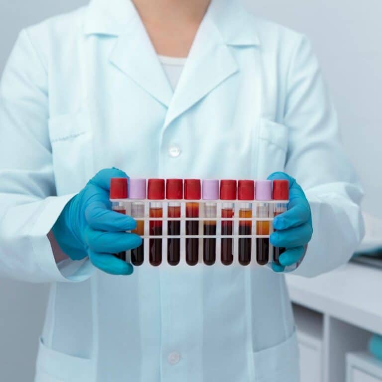 Blood test tubes in woman hands