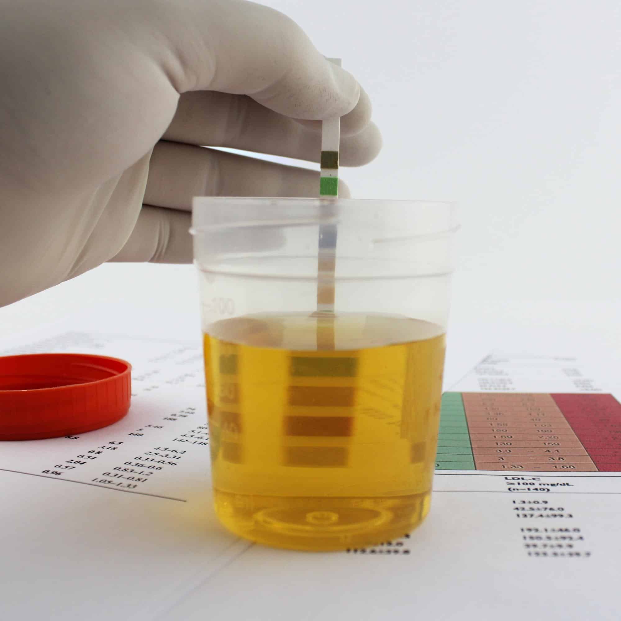 Urine test tube and urine strip