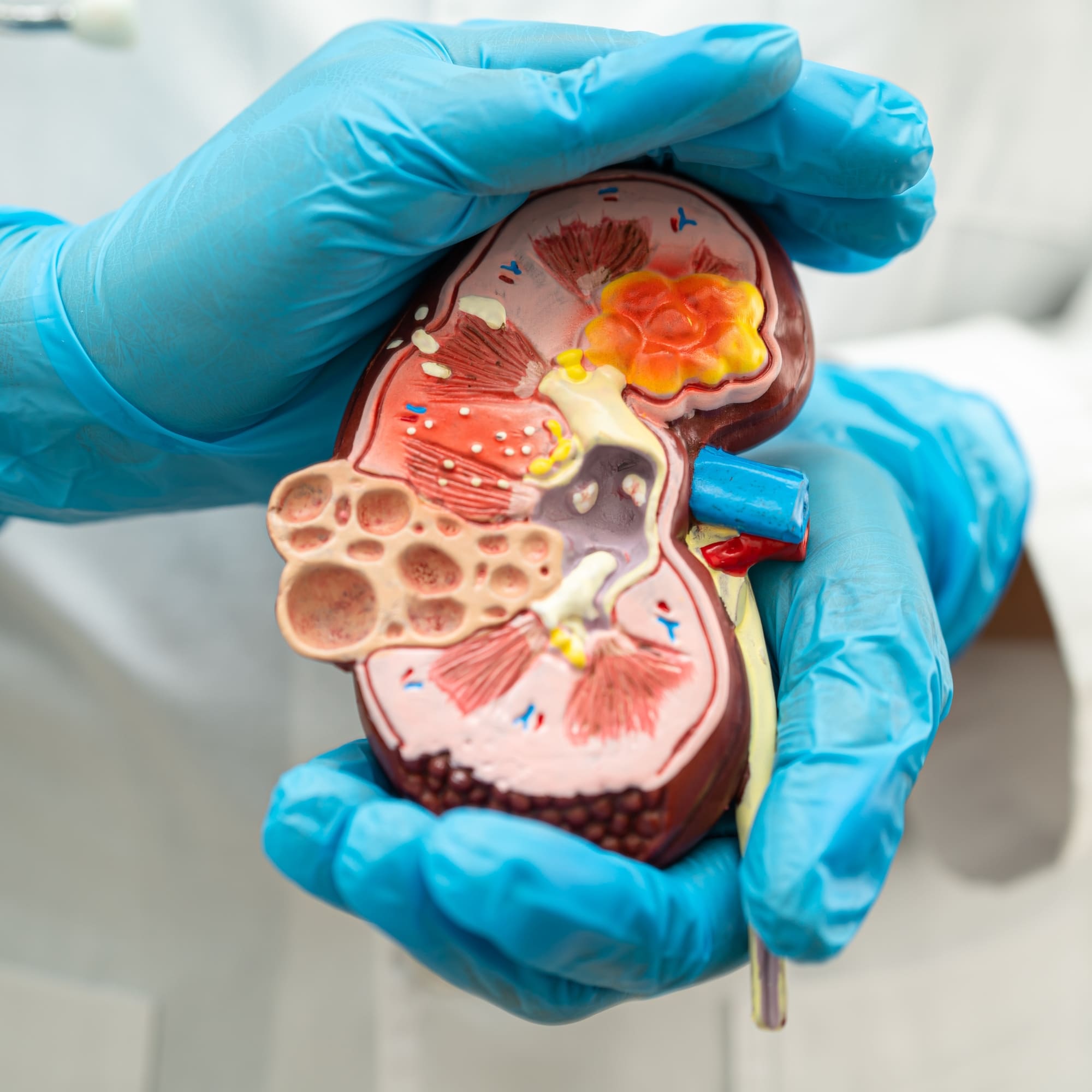 a doctor is holding a model of a human kidney