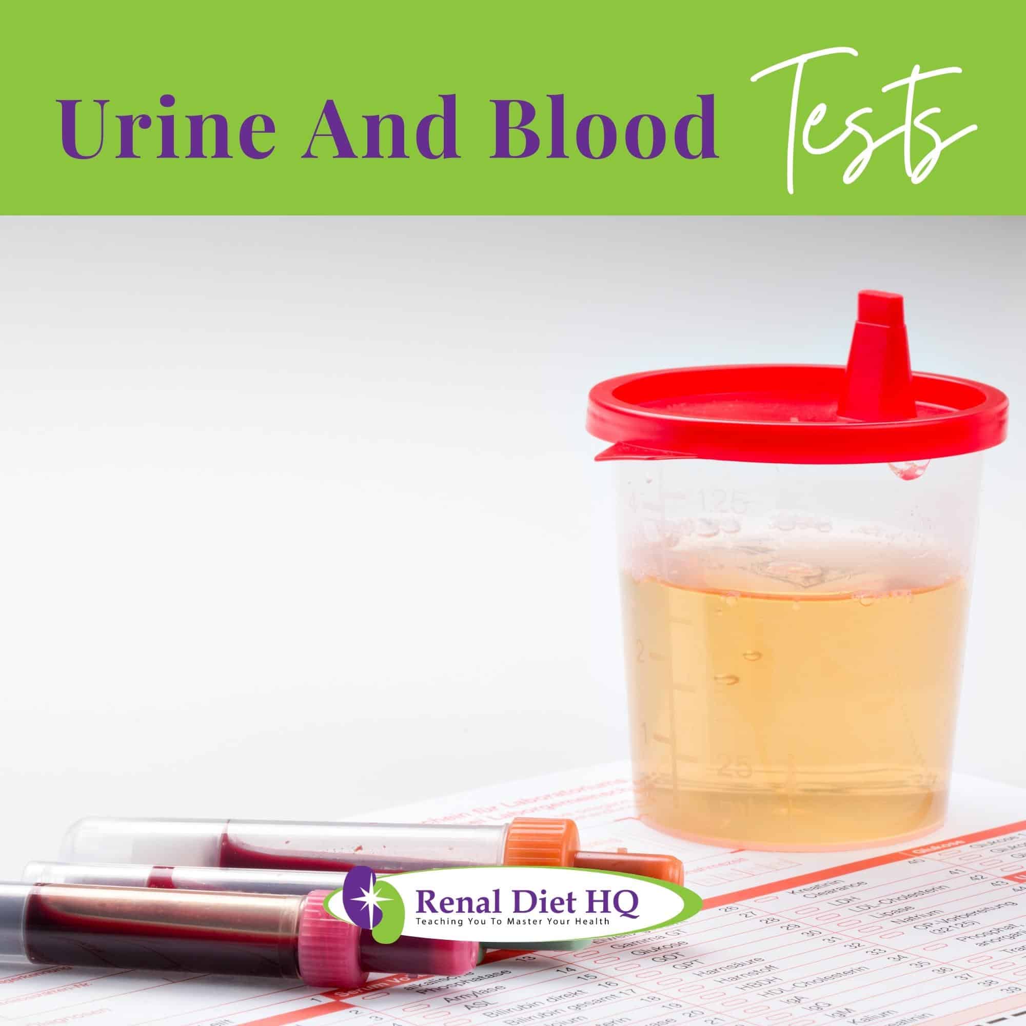 Urine and blood test (complete blood count)