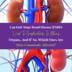 3D illustration of Kidneys