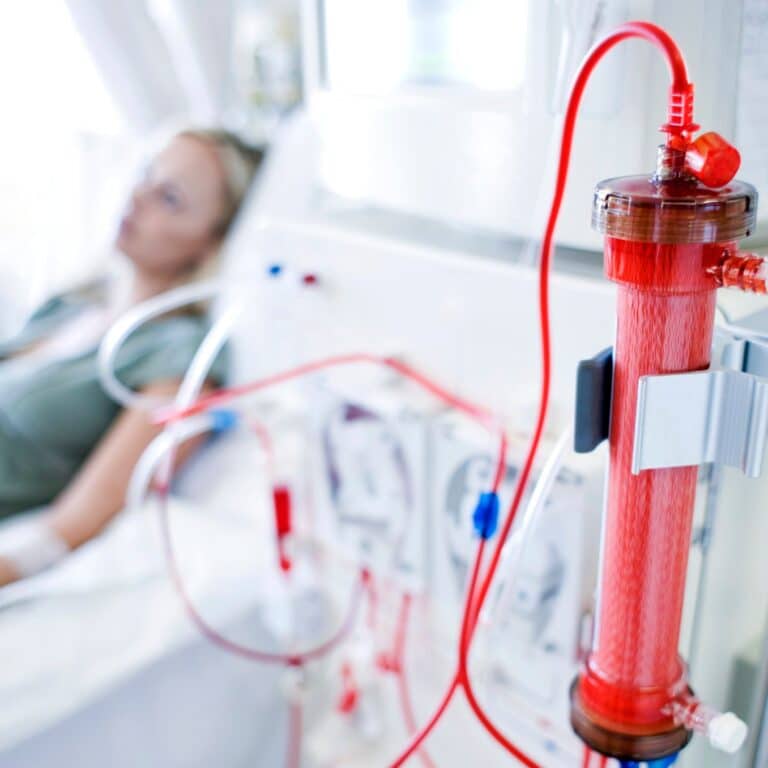 Dialysis Effect on Body