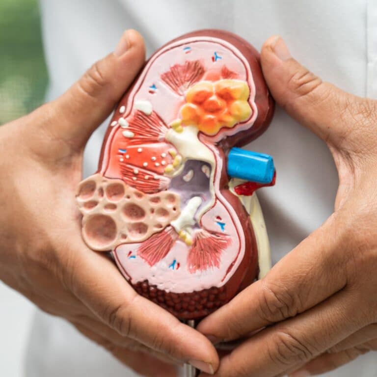 How Can I Control My Kidney Disease Naturally