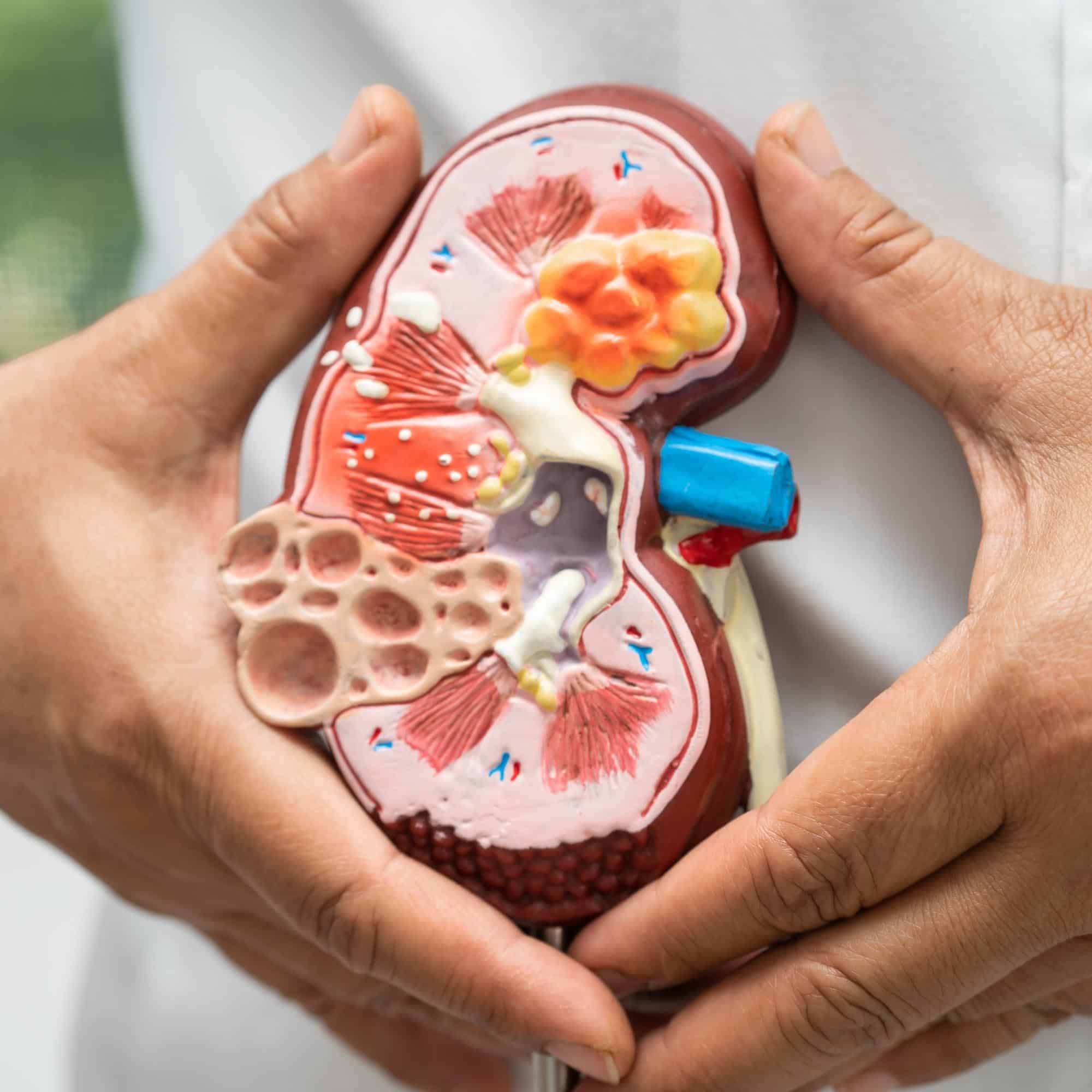 a medical professional is holding a model of a human kidney.