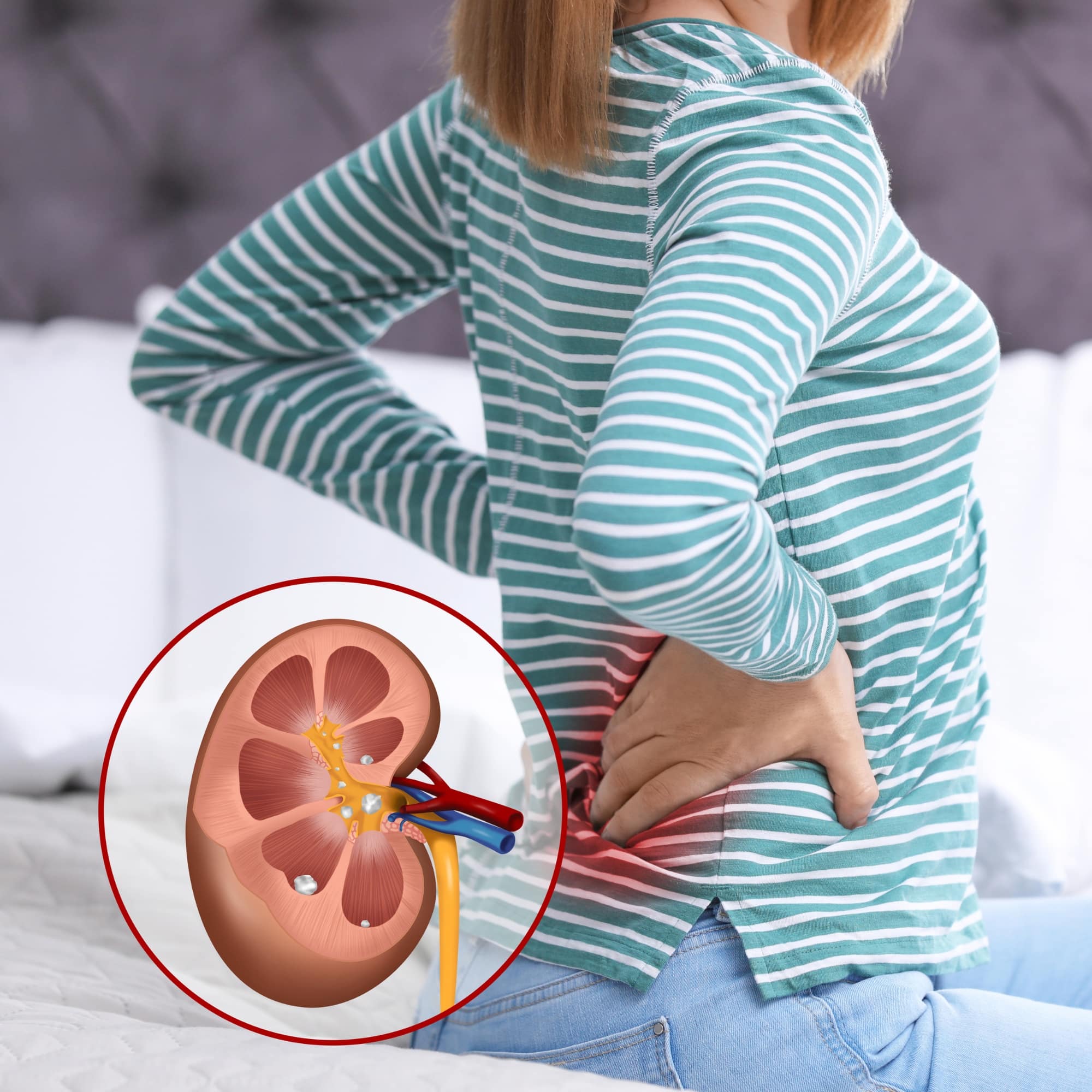 Young Woman Suffering from Back Pain because of Kidney stone