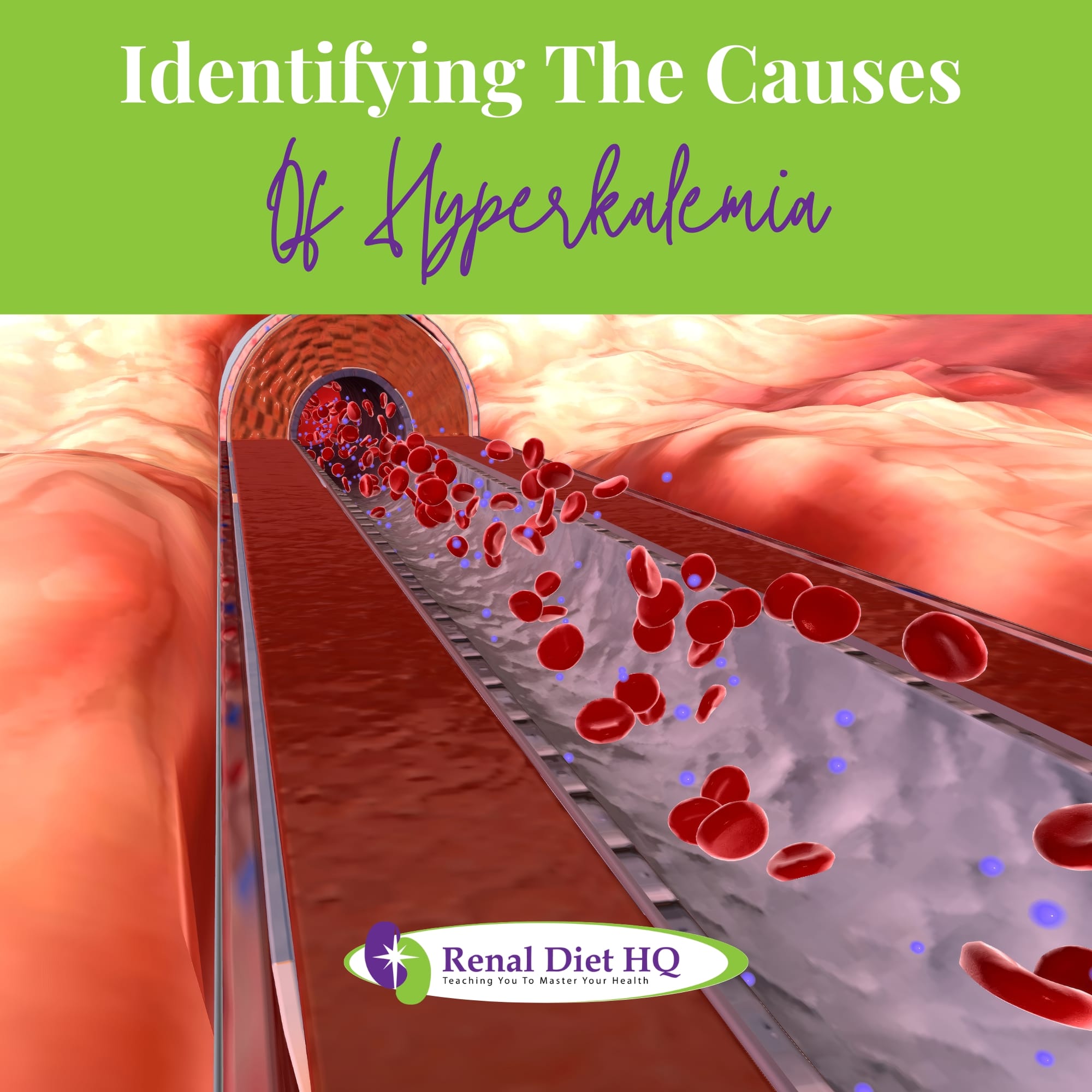 The Hyperkalemia, High Potassium Levels