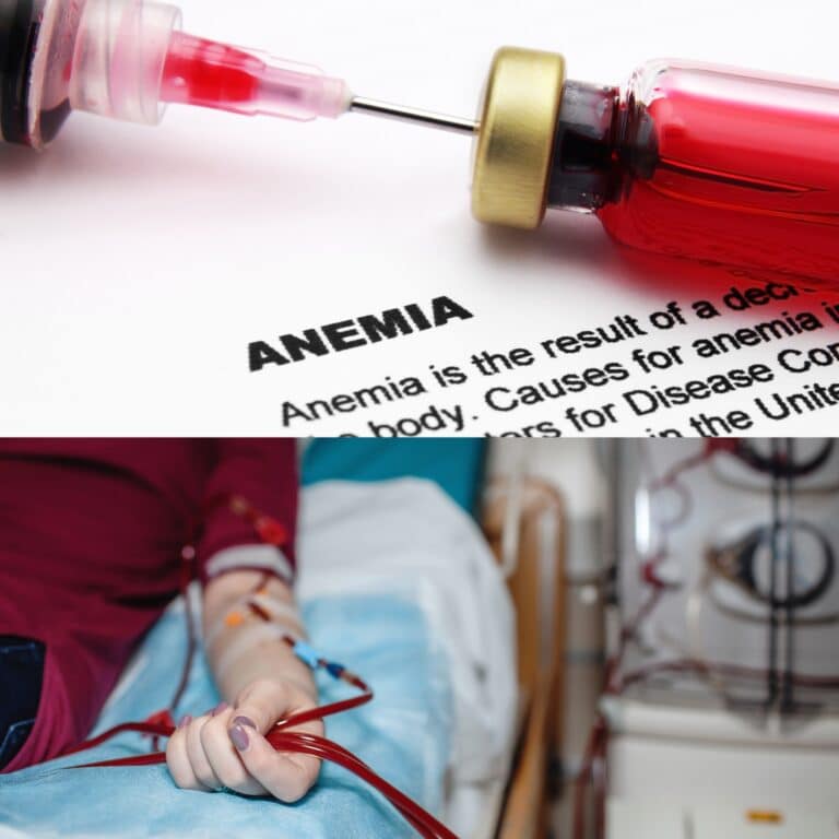 Syringe and vial on anemia text, Young Girl on Hemodialysis