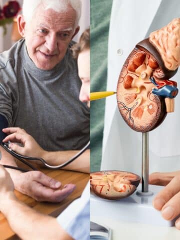 a doctor checking the blood pressure of a person and image of Chronic Disease Kidney Model