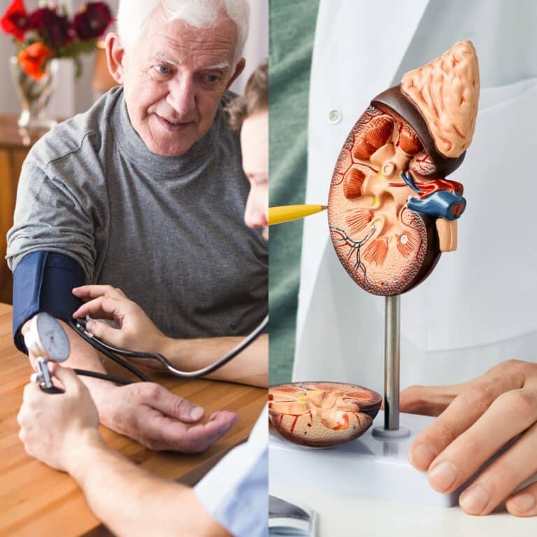 High Blood Pressure and Kidney Disease