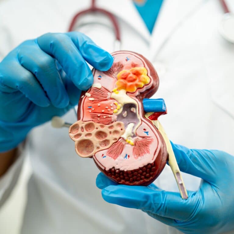 Kidney disease model holds by a doctor