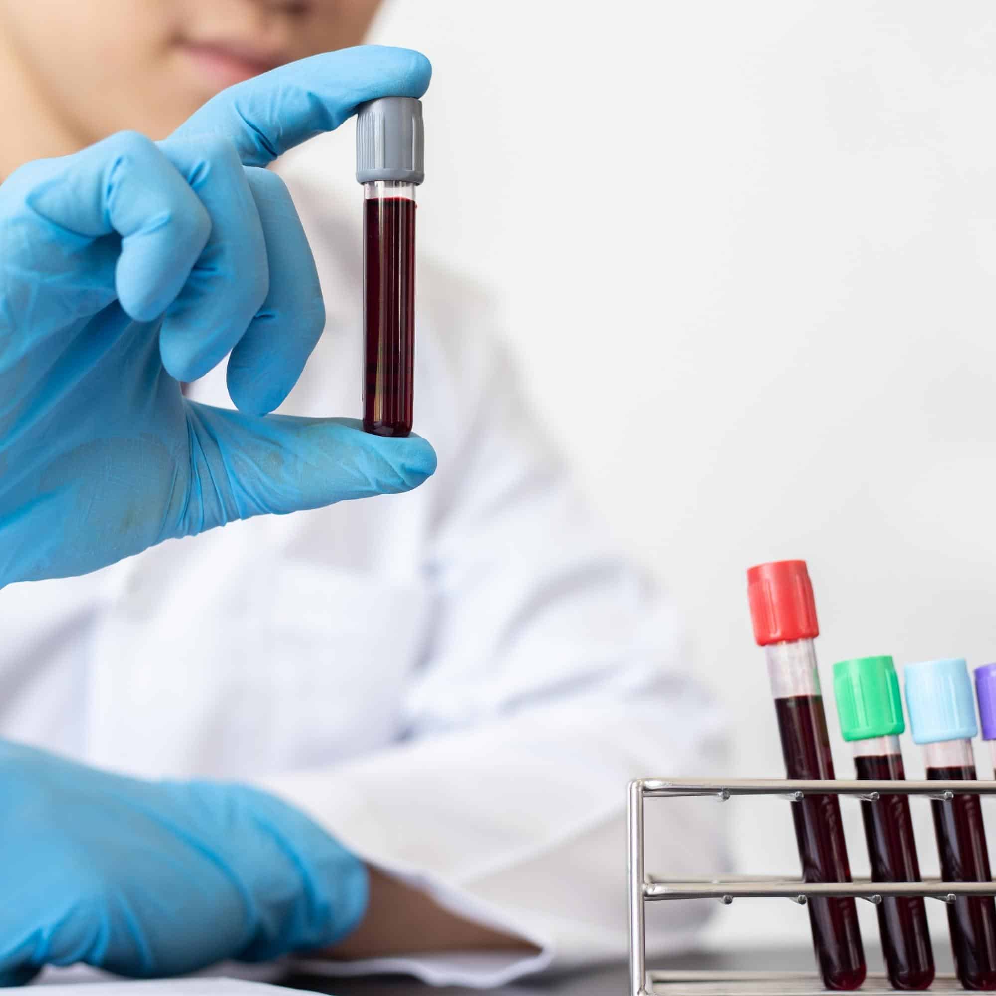 Blood test for creatinine screening